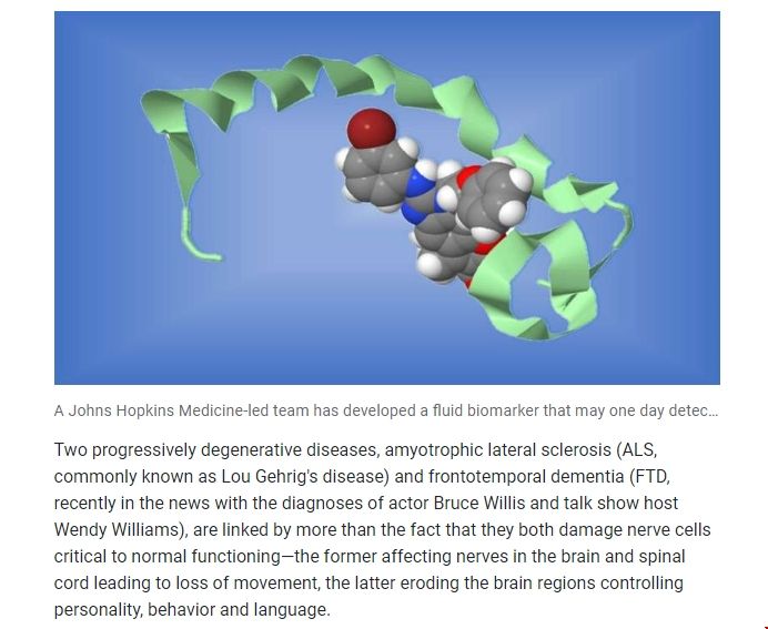 JHU大學發現ALS和FTD病癥的生物標志物.png JHU大學發現ALS和FTD病癥的生物標志物.png